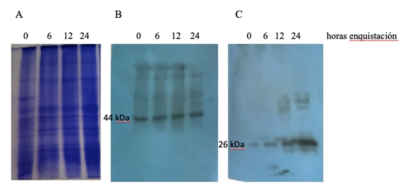 Figura 8.A Extractos totales de par�sitos de Giardia 1x106 par�sitos  durante las 24 horas de la enquistaci�n tinci�n con coomassie B Detecci�n de GdSir23 439 kDa por westernblot en extractos totales de los par�sitos enquistantes mostrados en la figura A 1� IgYα6xHisGdSir23 1500 2� α-IgY peroxidasa 110000 C Western blot de la prote�na control de la enquistaci�n CWP1 26 kDa2 1� α  CWP 1500 2� α-IgG peroxidasa 110000 Revelado sistema quimioluminiscente