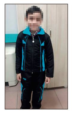 At the end of the first month, body weight was 18 kg. He also had a better general condition, was active and interested in his surroundings and gave clear answers to the questions. Written informed consent from the parents was obtained.