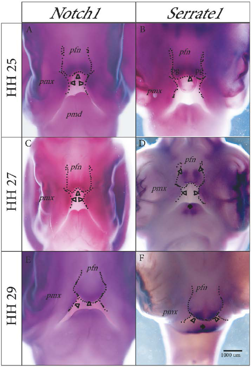 Vista frontal. Patrones de expresi&oacute;n
de los genes  Notch1 
y  Serrate1  durante el desarrollo del tercio medio
facial en embriones de pollo. A, C y E expresi&oacute;n de  Notch1  y B, D y E, expresi&oacute;n de  Serrate1  en los estadios HH25, HH27 y HH29,
respectivamente