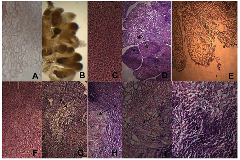 Estudio histol&oacute;gico de la inducci&oacute;n de callo y el estr&eacute;s h&iacute;drico por desecaci&oacute;n. A. C&eacute;lulas irregulares y alargadas del callo no embriog&eacute;nico (NE) (400X). B. M&uacute;ltiples primordios del callo rizog&eacute;nico (R) (200X). C. C&eacute;lulas embriog&eacute;nicas t&iacute;picas (400X). D. Masas pro embriog&eacute;nicas del callo (E) (200X). E. Embriones som&aacute;ticos aislados del cuerpo proembriog&eacute;nico (400X). F. Callo embriog&eacute;nico a 0 estr&eacute;s h&iacute;drico (200X). G. Callo embriog&eacute;nico a 24 h de estr&eacute;s h&iacute;drico (200X). H. Callo embriog&eacute;nico a 48 h de estr&eacute;s h&iacute;drico (200X). I. Vasos xilem&aacute;ticos en callos sometidos a desecaci&oacute;n. J. Callo embriog&eacute;nico a 72 h de estr&eacute;s h&iacute;drico (200X). CP: C&eacute;lulas plasmolizadas. MP: Masas pro embriog&eacute;nicas. V: tejido vascular. X. Vasos xilem&aacute;ticos.