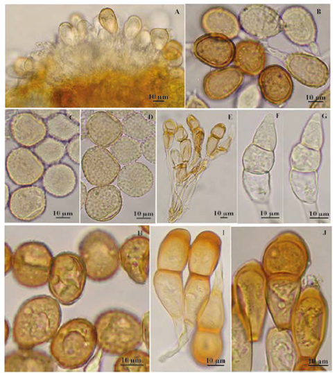 A-B. Puccinia caricina. A. Aspecto general del uredinio. B. Uredosporas con poros ecuatoriales (flecha). C-G. Puccinia cephalotes. C-D. Uredosporas. C. Vista superficial. D. Vista mediana. E-F. Teliosporas. E. Teliosporas de dos c&eacute;lulas. F. Teliosporas de tres c&eacute;lulas. H-J. Puccinia dioicae. H. Uredosporas con poros ecuatoriales (flecha). I-J. Teliosporas. I. Teliosporas de dos c&eacute;lulas J. Mesosporas.