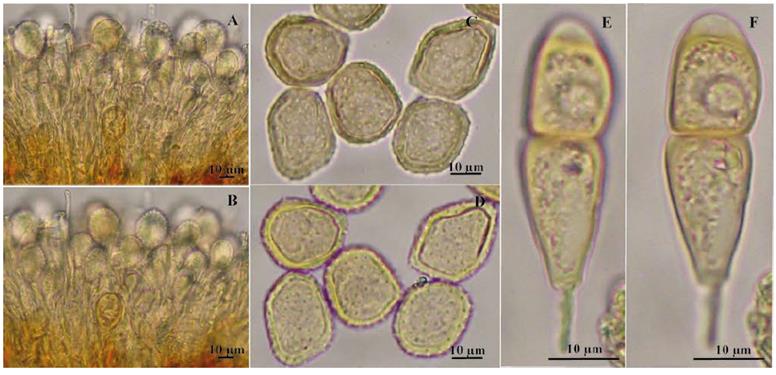A-F. Puccinia sonsonensis. A-B. Uredinio. A. Vista superficial. B. Vista mediana. C-D. Uredosporas. C. Vista superficial. D. Vista mediana. E-F- Teliospora. E. Vista superficial. F. Vista mediana.