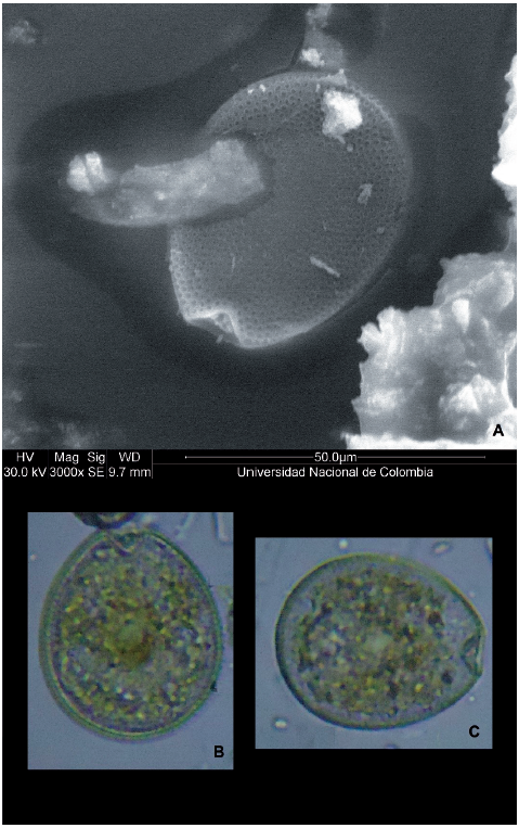 Prorocentrum hoffmannianum. (A) SEM, (B and C) Optical microscopy (40X).