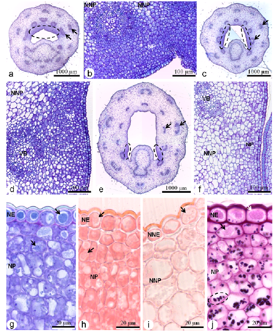 Bauhinia monandra hypanthium and nectary tissues. (a-f) Cross-section of the basal (a, b), middle (c, d), and apical (e, f) third parts of the hypanthium. In smaller magnification (a, c, e), hypanthium overview, evidencing the nectary tissues (ellipses) and vascular bundles (arrows). In greater magnification (b, d, f), regions with nectary tissues, indicated by ellipses in a, c, e. (g-j) Cross-sections of the hypanthium in high magnification, stained with Toluidine blue O (g), Ponceau Xylidine (h, i) and Periodic Acid Schiff reaction (j), in the nectary tissues (g, h, j) and non-nectary tissues (i). Intravacuolar corpuscles (arrows) (g-j) and some starch grains in a nectary parenchyma cell are in evidence (ellipse) (j). Legends: NE-nectary epidermis, NNE- non-nectary epidermis, NNP- non-nectary parenchyma, NP- nectary parenchyma, VB- vascular bundle.