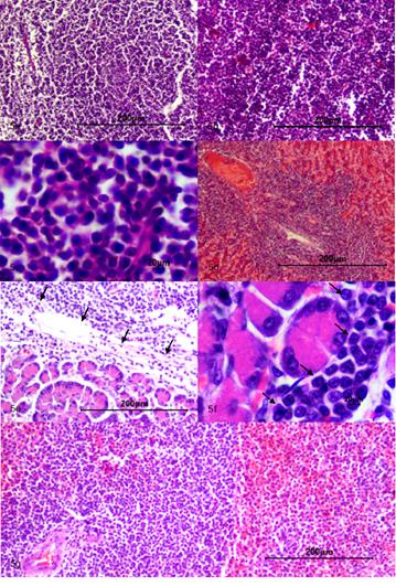 (a, b) N&oacute;dulo linf&aacute;tico 10x, con proliferaci&oacute;n celular neopl&aacute;sica de origen linfoide con un patr&oacute;n de crecimiento infiltrativo que compromete corteza y medula. (c) N&oacute;dulo linf&aacute;tico 40x, n&oacute;tese c&eacute;lulas neopl&aacute;sicas correspondientes a linfocitos, de forma redondeada y tama&ntilde;o peque&ntilde;o. Se observa moderado pleomorfismo nuclear, moderada anisocariosis y severa megalocariosis. (d) H&iacute;gado 10x, n&oacute;tese la presencia de c&eacute;lulas neopl&aacute;sicas que infiltran el par&eacute;nquima funcional de apariencia linfoide con caracter&iacute;stica similar a las reportadas en los dem&aacute;s tejidos. (e) P&aacute;ncreas 10x, (f) P&aacute;ncreas 40x, se evidencia foco de infiltrado de c&eacute;lulas neopl&aacute;sicas de origen linfoide posiblemente asociado a una met&aacute;stasis (fechas negras). (g) Bazo 10x, en la pulpa blanca se observa proliferaci&oacute;n celular neopl&aacute;sica de tipo linfoide con un patr&oacute;n de crecimiento infiltrativo pobremente delimitado el cual se extiende al par&eacute;nquima funcional (Pulpa roja). 