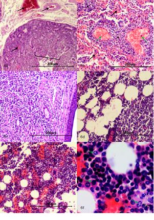 (a) Intestino delgado 4x con cambios microcirculatorios, m&uacute;ltiples focos de congesti&oacute;n, hemorragia y enlodamiento con distribuci&oacute;n multifocal en mucosa y submucosa (flechas negras), mucosa con atrofia y fusi&oacute;n de las vellosidades (llave). (b) Pulm&oacute;n 10x con severos cambios microcirculatorios (m&uacute;ltiples focos de congesti&oacute;n (flechas verdes), hemorragia y enlodamiento (flechas negras) con distribuci&oacute;n multifocal, presencia de m&uacute;ltiples focos correspondientes a c&eacute;lulas neopl&aacute;sicas de origen linfoide las cuales corresponden a met&aacute;stasis pulmonar (estrellas negras). (c) Piel 4x, dermis con evidencia de proliferaci&oacute;n celular neopl&aacute;sica de origen linfoide, se organiza a manera de paquetes celulares densos pobremente delimitados por estroma de tejido conectivo con un patr&oacute;n de distribuci&oacute;n infiltrativo. (d) Tejido adiposo 10x con presencia de c&eacute;lulas neopl&aacute;sicas de origen linfoide. (e) M&eacute;dula &oacute;sea 10x, (f) M&eacute;dula &oacute;sea 40x, se evidencia aumento de la fracci&oacute;n celular con presencia de c&eacute;lulas neopl&aacute;sicas de origen linfoide (flechas verdes). 