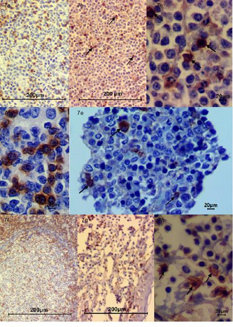 Inmunohistoqu&iacute;mica. (a) Control CD3 N&oacute;dulo linf&aacute;tico 10x; (b) CD3 N&oacute;dulo linf&aacute;tico 10x, n&oacute;tese moderada inmunomarcaci&oacute;n (flechas negras); (c) CD3 N&oacute;dulo linf&aacute;tico 40x, se evidencia moderada inmunomarcaci&oacute;n (flechas negras); (d) Control CD3 N&oacute;dulo Linf&aacute;tico 40X; (e) CD3 M&eacute;dula &Oacute;sea 40x se evidencia moderada inmunomarcaci&oacute;n (flechas negras).; (f) Control CD3 N&oacute;dulo linf&aacute;tico 4x; (g) CD3 Piel 10X, se evidencia moderada inmunomarcaci&oacute;n; (h) CD3 Piel 40x se evidencia moderada inmunomarcaci&oacute;n (flechas negras).