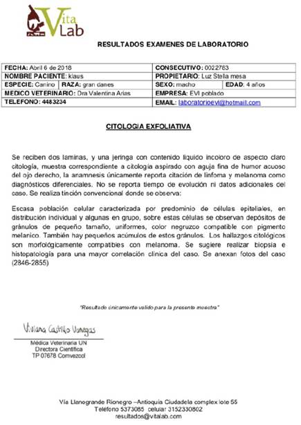 Diagnóstico de histopatología, confirmando Melanoma ocular uveal.