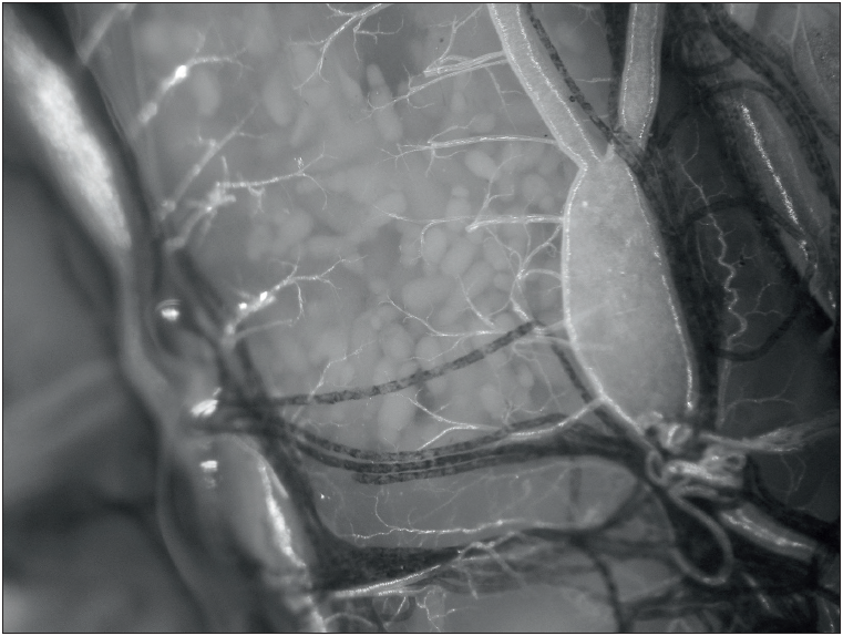 Infección de
categoría Fuerte
