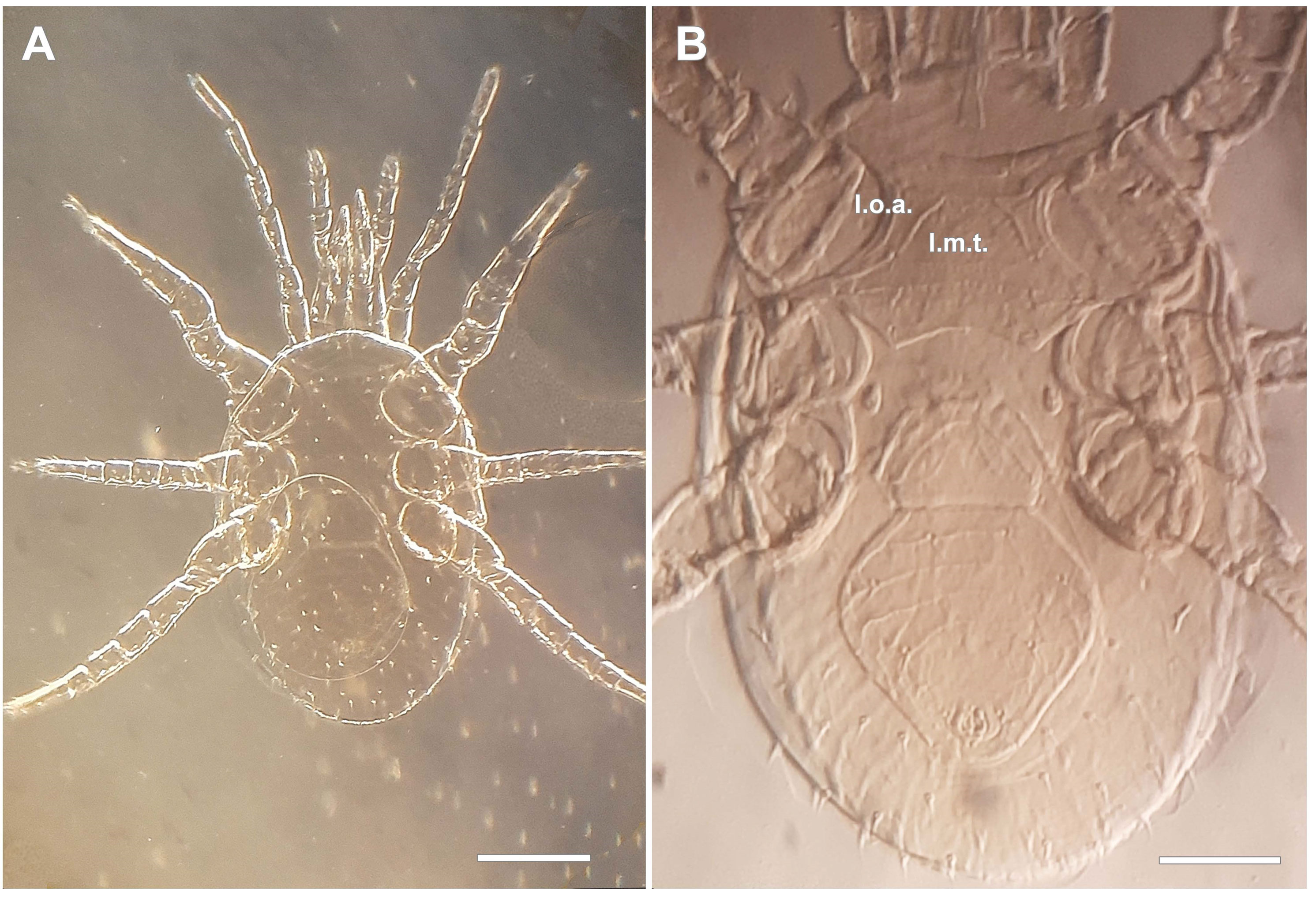 Fig. 2. Macrocheles subbadius (Berlese), female (MACN-Ar 41784). A. dorsal view, dark field. B. ventral idiosomal view, phase contrast.