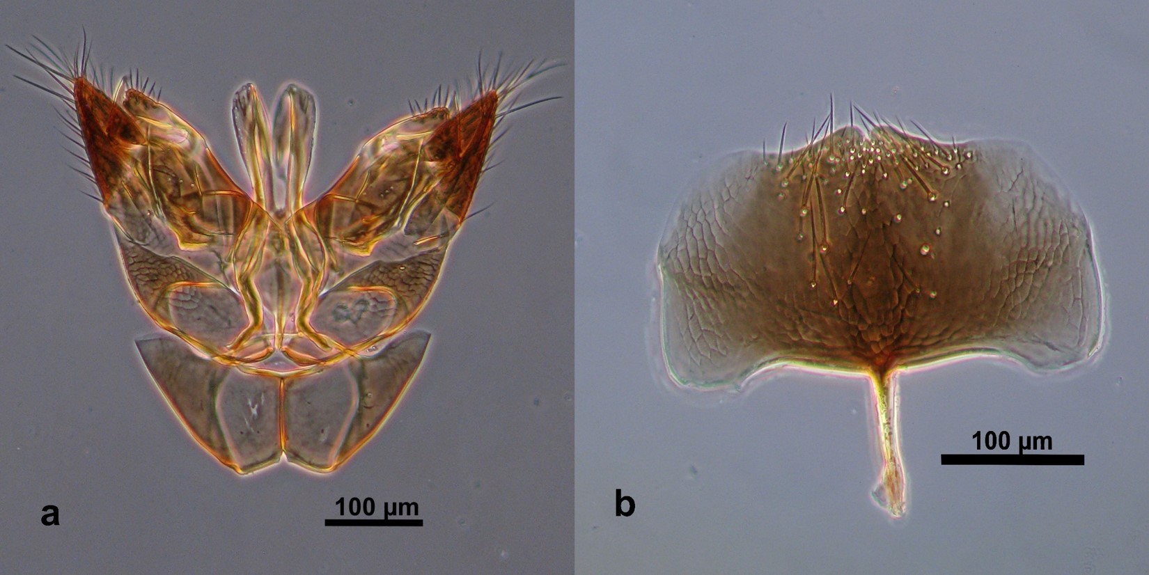 Genitalia del macho de Goniozus legneri. a. Genitalia. b. hipopigio.