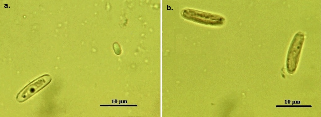 Apicystis sp. oocysts.