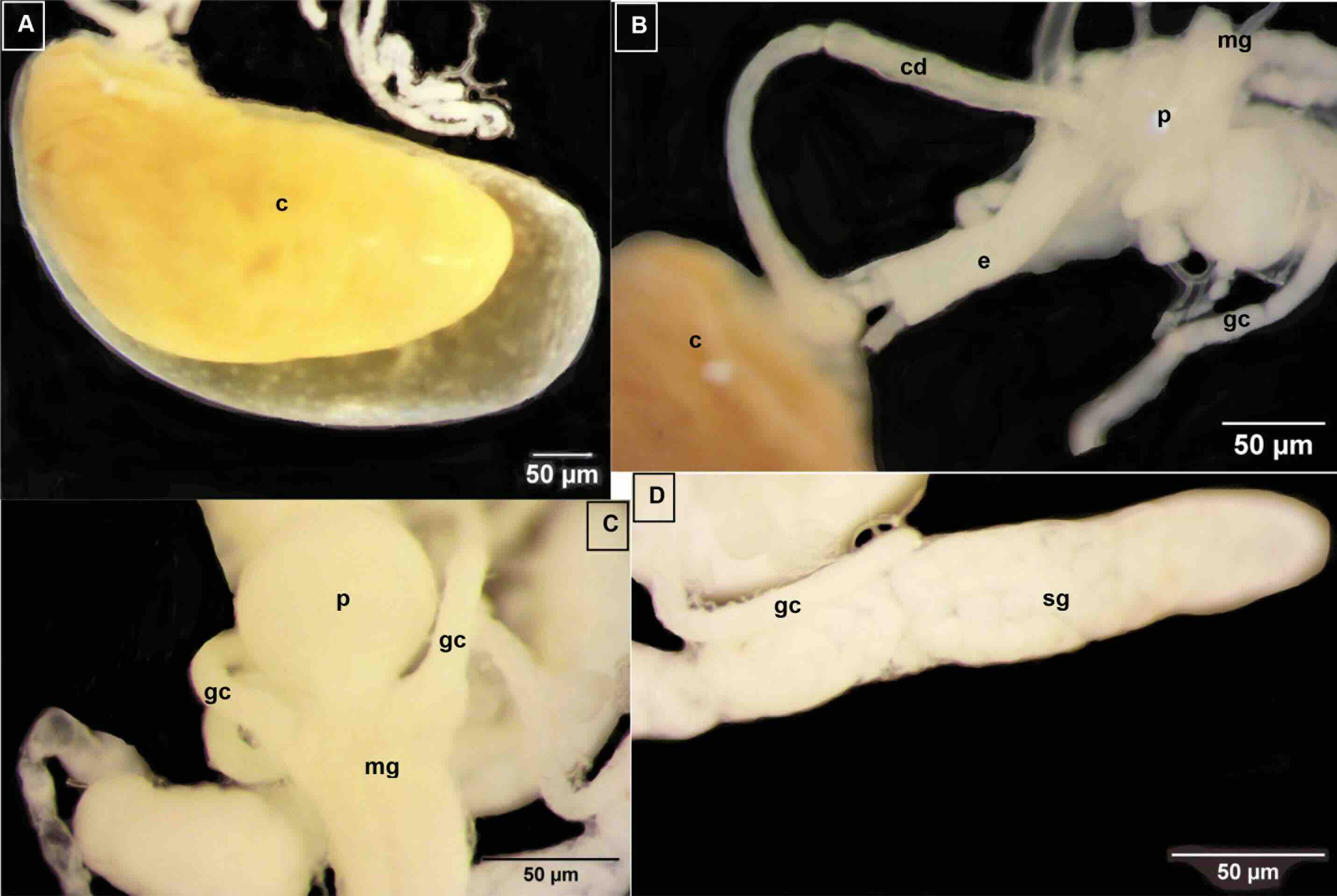 Digestive system of Calliphora vicina larva
