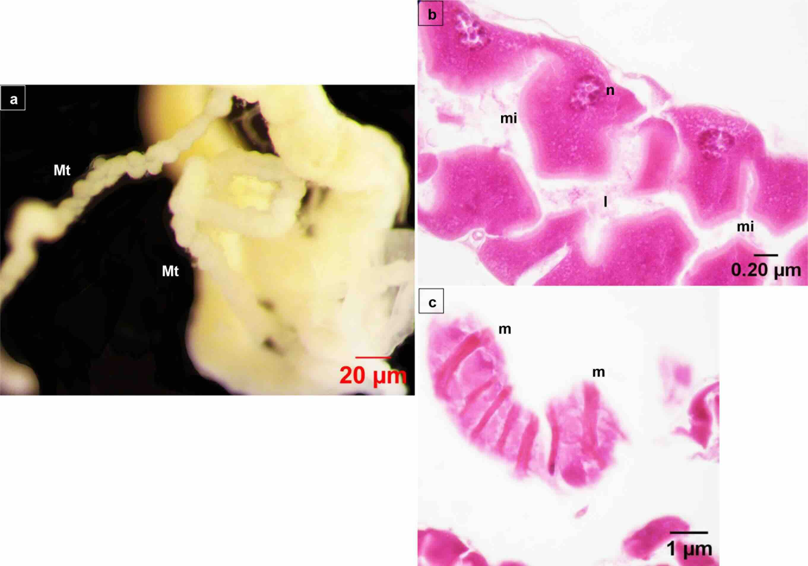 Malpighian tubules of Calliphora vicina larva