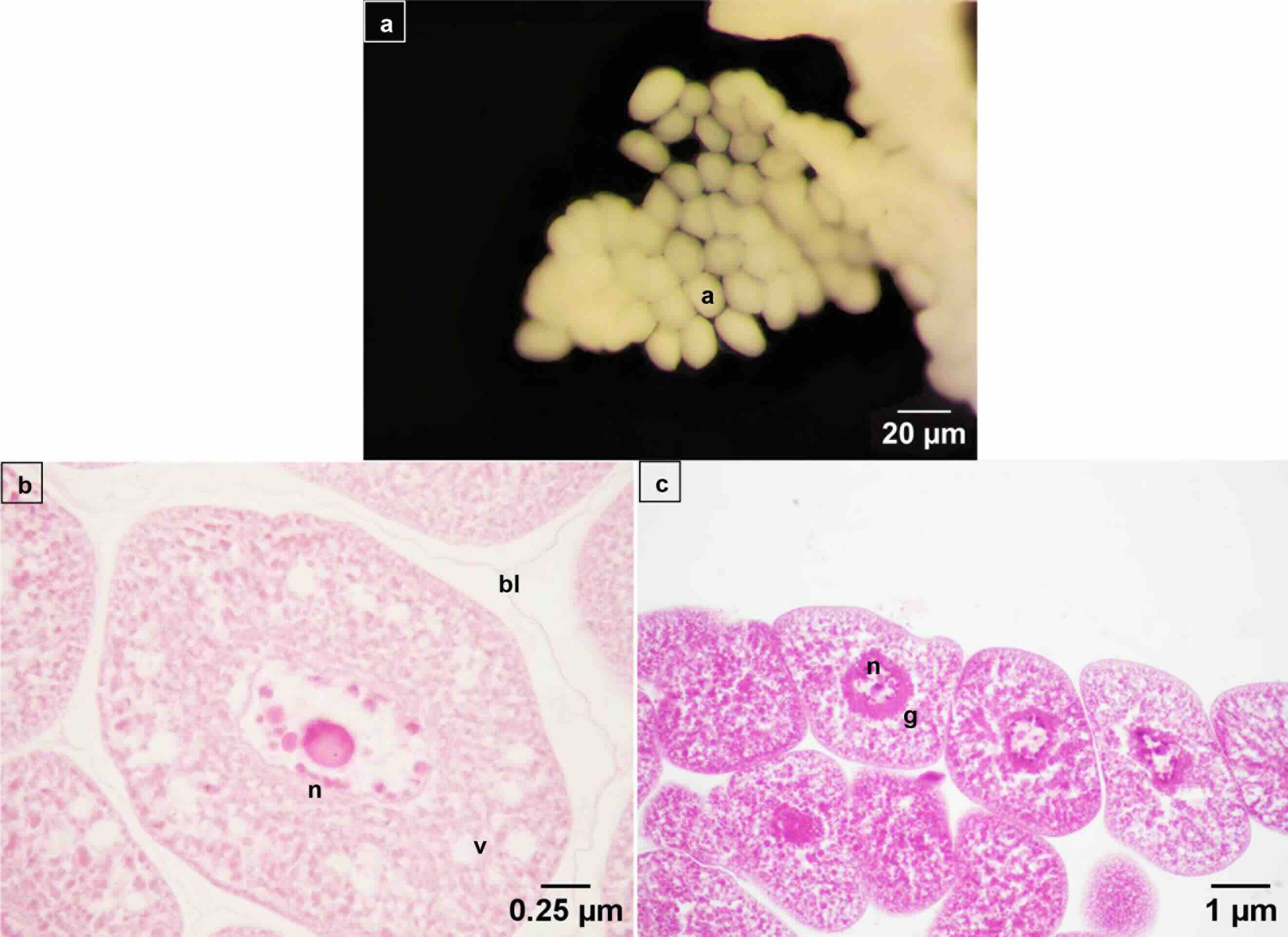Fat bodies of Calliphora vicina larva