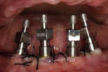 Transfers en posici�n.v