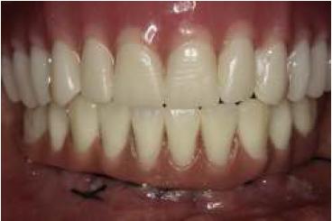 Vista frontal de la rehabilitaci�n reci�n instalada.