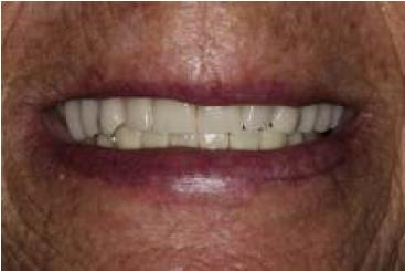 Control del caso cl�nico a los 2 a�os.