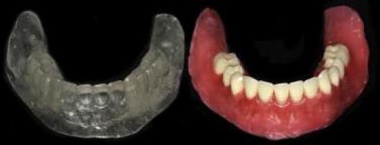 Enfilado dentario y gu�a multifuncional acr�lica.