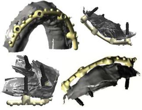 Diseño asistido por ordenador.