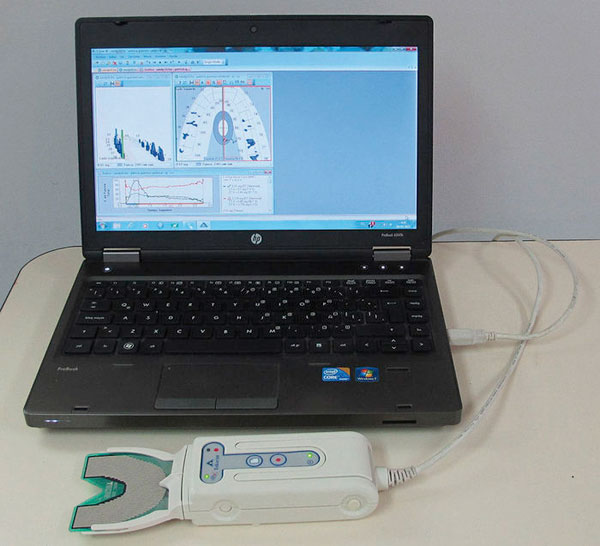Sistema T-Scan� III instalado en notebook, tal como se utiliza en la cl�nica odontol�gica.