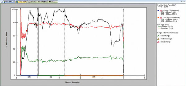 Gr�fico. A. Porcentaje de fuerza total/tiempo (s). Total de tiempo de grabaci�n 10 seg. Lado izquierdo l�nea color verde. Lado derecho l�nea color rojo. L�nea de m�xima fuerza en negro. A: Marcas de inicio; B: Marca de primer contacto m�ximo; C: Marca de �ltimo m�ximo contacto; D: Marca de �ltimo contacto de desoclusi�n. DT: Tiempo de desoclusi�n; IP: tiempo de oclusi�n en posici�n intercuspal; OTA: marcas de inicio; OTB: marcas de tiempo final de oclusi�n; OT: tiempo desde primer contacto dentario hasta posici�n intercuspal.