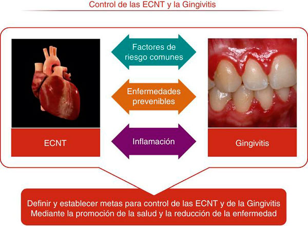 Las enfermedades periodontales comparten factores de riesgo con las ENT.