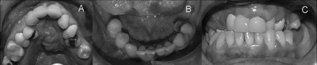 Fotografías iniciales de la paciente