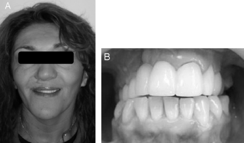 Fotografías posteriores al tratamiento