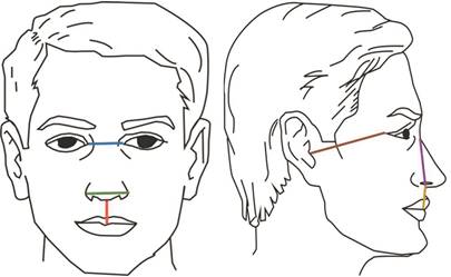 Distancias faciales registradas, presentadas en colores sobre un esquema facial.