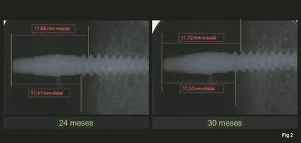 Radiograf&iacute;as digitalizadas donde se realizaron las mediciones