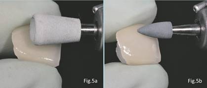 Pulido manual con sistema Optrafine®. Pulidor abrasivo Figura 5b. Pulido manual con sistema Optrafine®. Pulidor fino