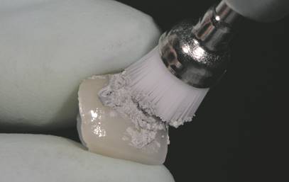 Finalización secuencia de pulido manual con pasta de pulido Optrafine®