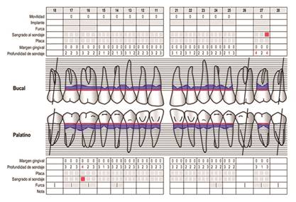 Ficha periodontal de mantenimiento.