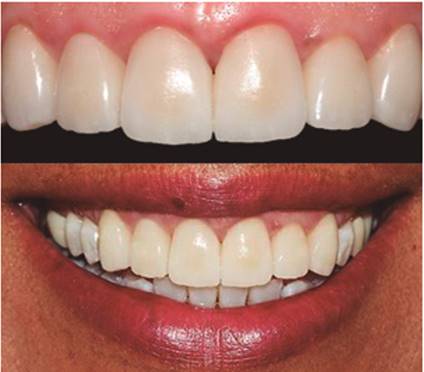 Caracter&iacute;sticas cl&iacute;nicas finales.