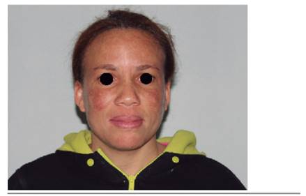 Foto cl&iacute;nica preoperatoria