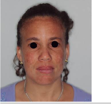 Foto cl&iacute;nica postoperatoria