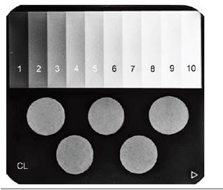 Radiografía representativa de las muestras de cemento de resina (Calibra) con la cuña de aluminio escalonada