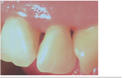 Papila 2.1-2-2 inicial.