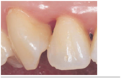Papila 1.1-1.2 final.