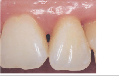 Papila 2.1-2.2 final.