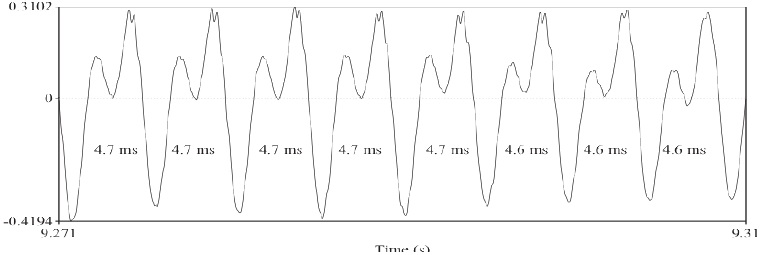 Ejemplo de vibraci&oacute;n de las cuerdas vocales durante fonaci&oacute;n modal