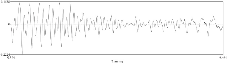 Ejemplo de vibraci&oacute;n de las cuerdas vocales durante fonaci&oacute;n laringalizada