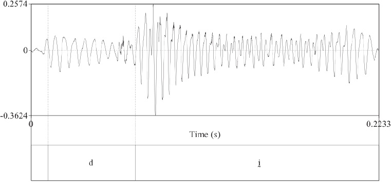 Laringalizaci&oacute;n en el centro de la vocal pero con propagaci&oacute;n a los lados