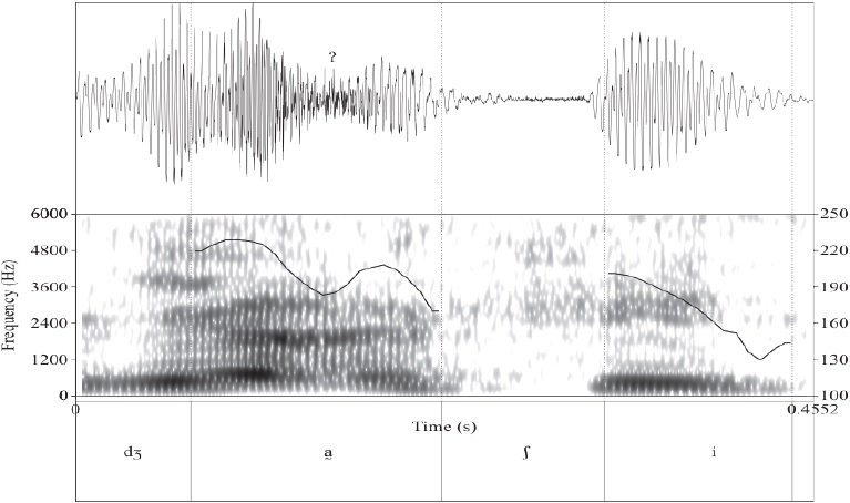 Ca&iacute;da de la frecuencia fundamental durante la fonaci&oacute;n laringalizada