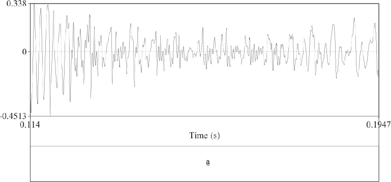Laringalizaci&oacute;n con vibraciones aperi&oacute;dicas