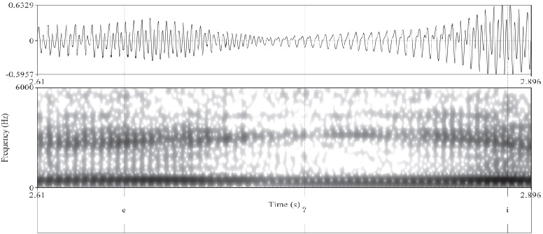 Oclusiva glotal en contexto intervoc&aacute;lico