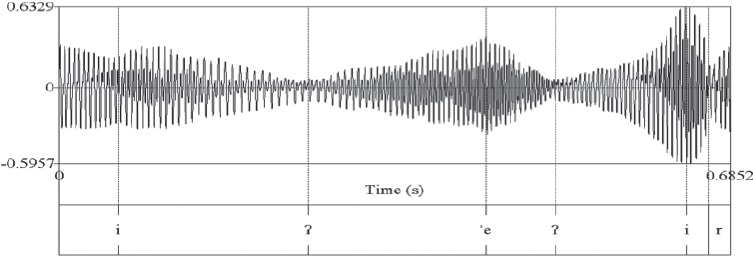 Laringalizaci&oacute;n se convierte en oclusiva glotal: /i? e.../ ? [i.?e...]
