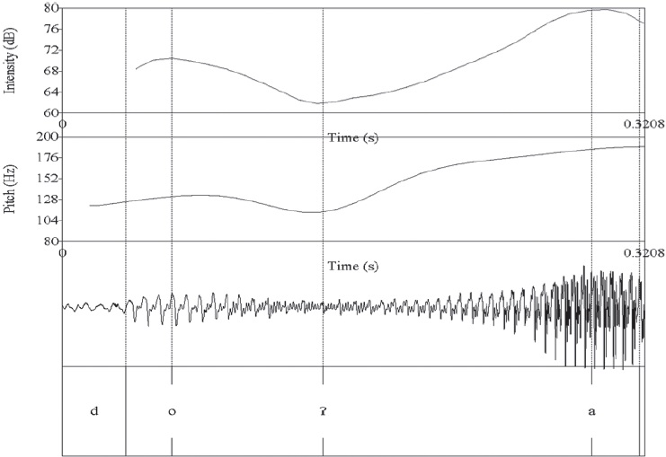 Laringalizaci&oacute;n intervoc&aacute;lica - Ca&iacute;da de intensidad y F0