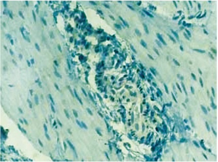 Histopatolog&iacute;a